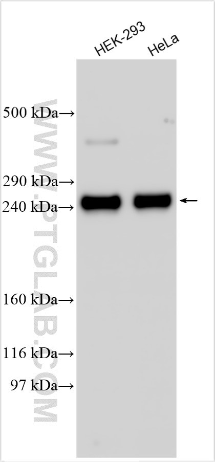 TTC28 Antibody in Western Blot (WB)