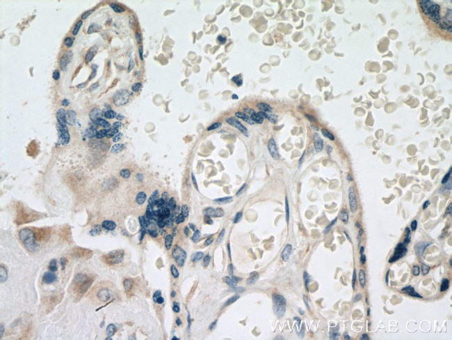 GDPD5 Antibody in Immunohistochemistry (Paraffin) (IHC (P))