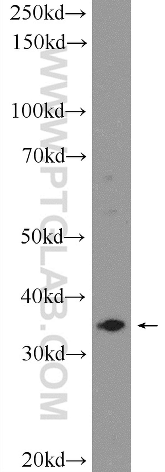 ARMCX3 Antibody in Western Blot (WB)