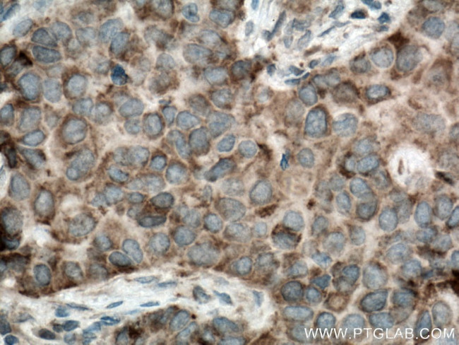 CXorf61 Antibody in Immunohistochemistry (Paraffin) (IHC (P))
