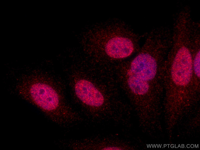 UHRF2 Antibody in Immunocytochemistry (ICC/IF)