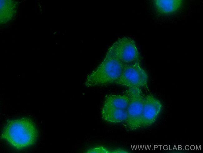 MAP6/STOP Antibody in Immunocytochemistry (ICC/IF)