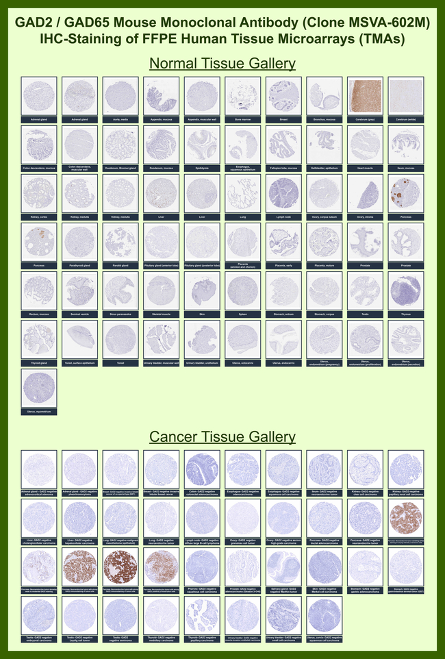 GAD2/GAD65 (GABAergic Neuronal Marker) Antibody in Immunohistochemistry (Paraffin) (IHC (P))