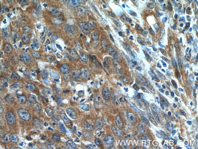 BLOC1S3 Antibody in Immunohistochemistry (Paraffin) (IHC (P))