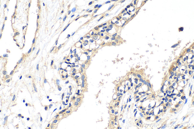 ATP1A3 Antibody in Immunohistochemistry (Paraffin) (IHC (P))