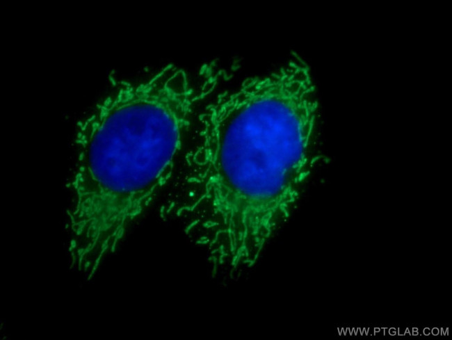 SERAC1 Antibody in Immunocytochemistry (ICC/IF)