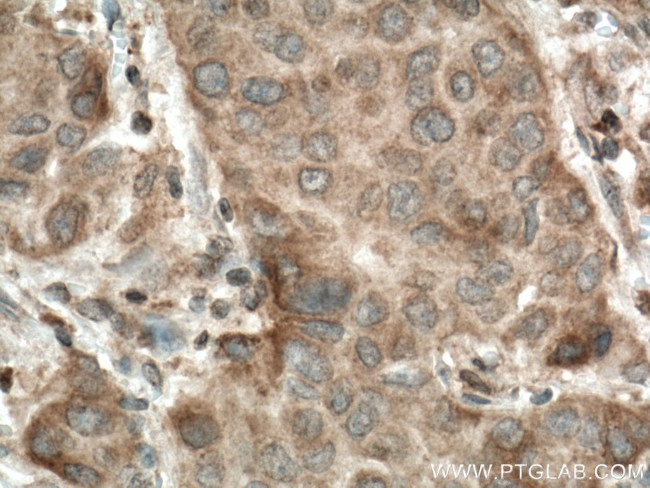 CERK Antibody in Immunohistochemistry (Paraffin) (IHC (P))