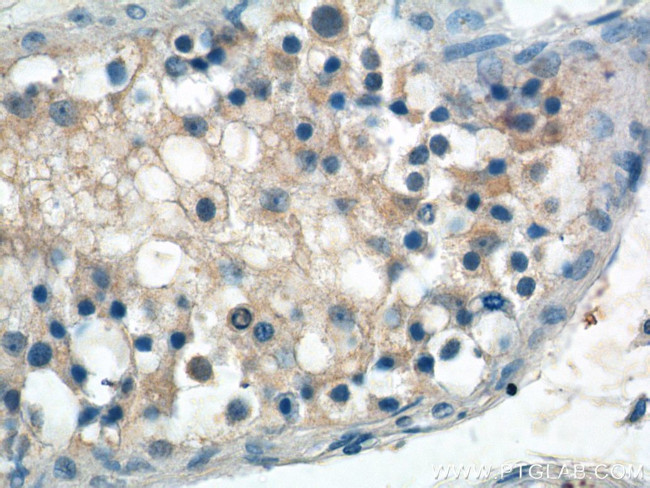ANKRD13B Antibody in Immunohistochemistry (Paraffin) (IHC (P))