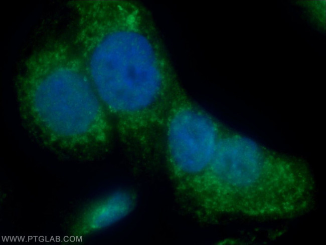 IQCK Antibody in Immunocytochemistry (ICC/IF)