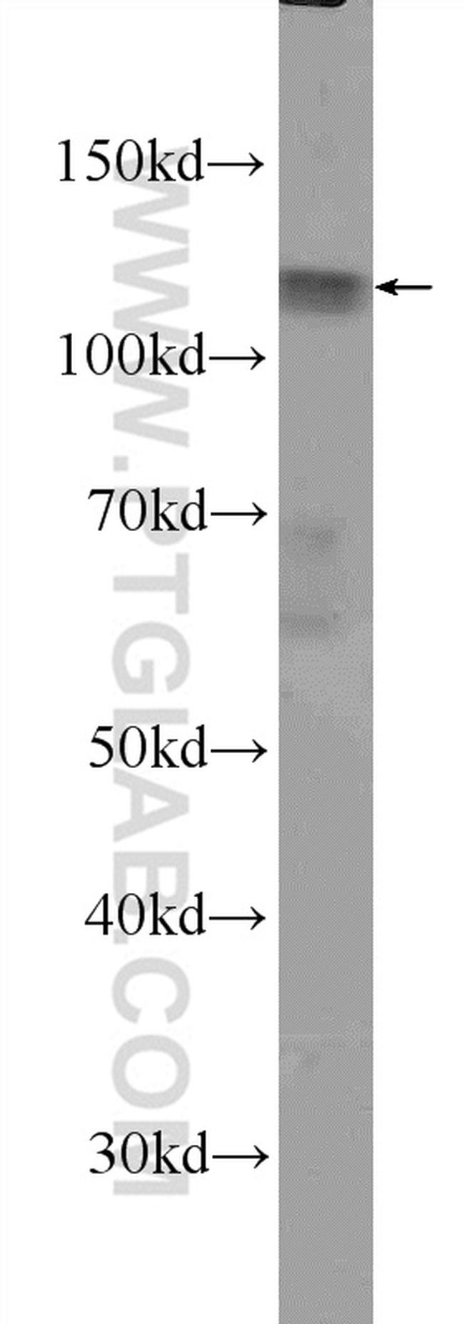 DIS3L Antibody in Western Blot (WB)