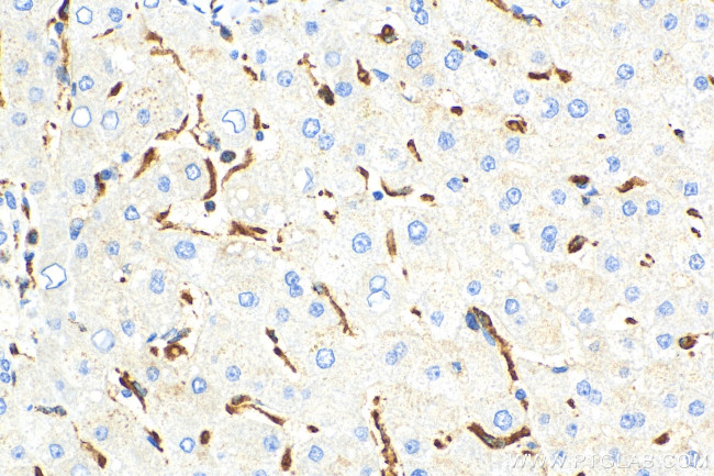 CD68 Antibody in Immunohistochemistry (Paraffin) (IHC (P))