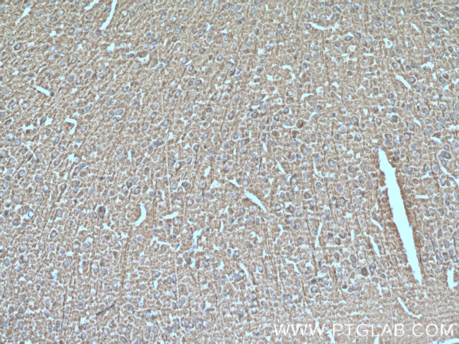 SNX32 Antibody in Immunohistochemistry (Paraffin) (IHC (P))