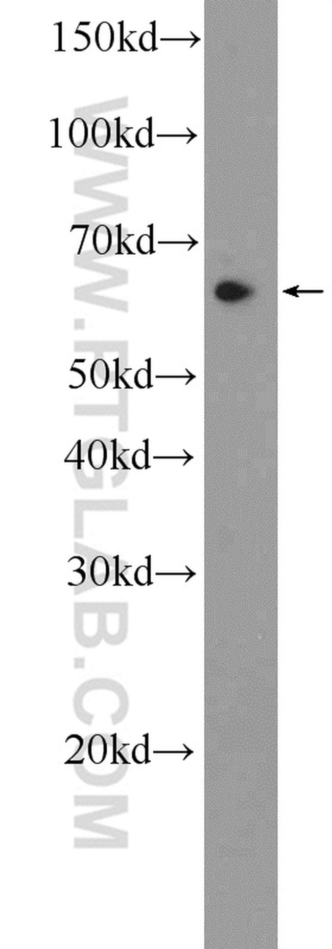 CCDC102A Antibody in Western Blot (WB)
