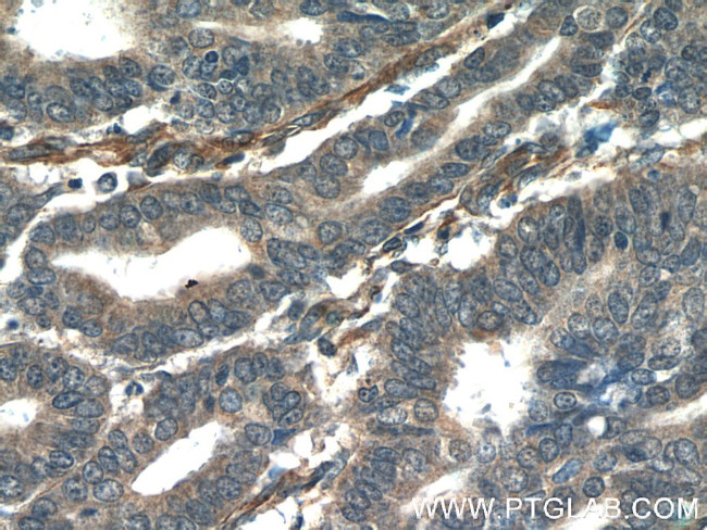 ORAI3 Antibody in Immunohistochemistry (Paraffin) (IHC (P))