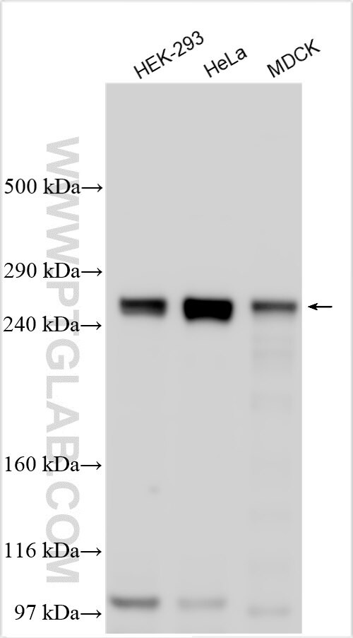 MTCL1 Antibody in Western Blot (WB)