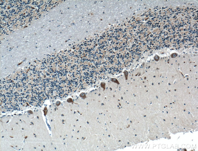 LRP2BP Antibody in Immunohistochemistry (Paraffin) (IHC (P))