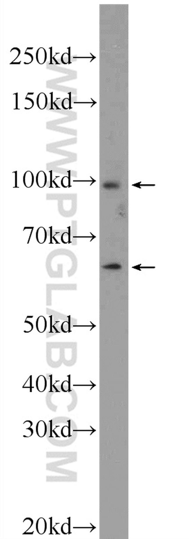 DIS3L2 Antibody in Western Blot (WB)