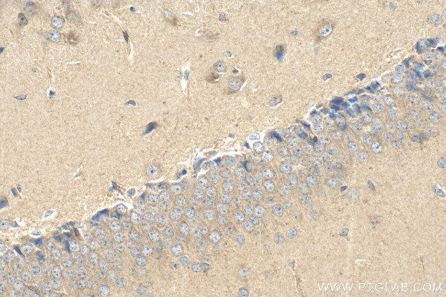 LRRN4 Antibody in Immunohistochemistry (Paraffin) (IHC (P))
