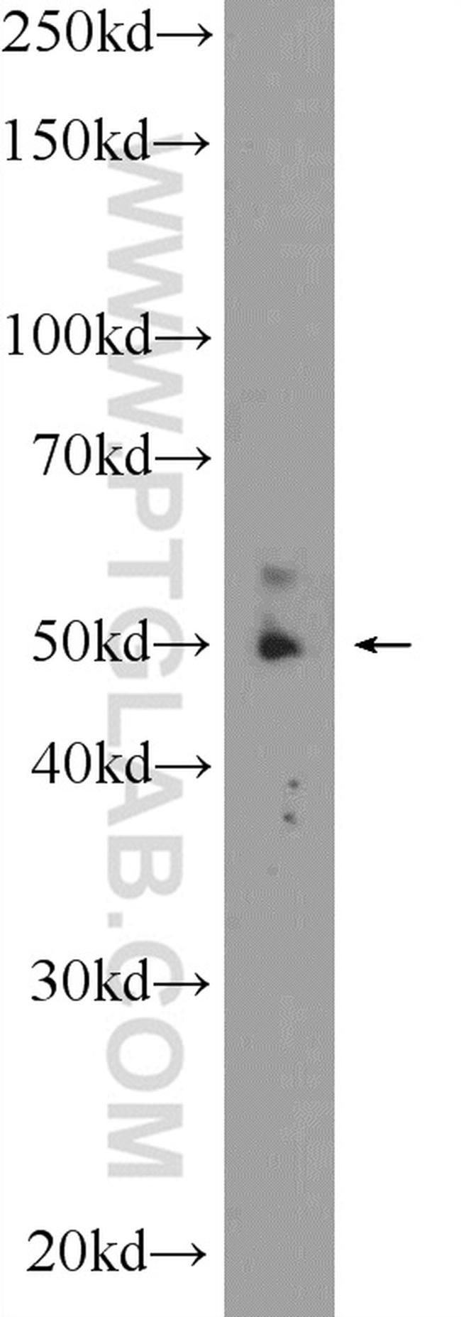 ZNF649 Antibody in Western Blot (WB)