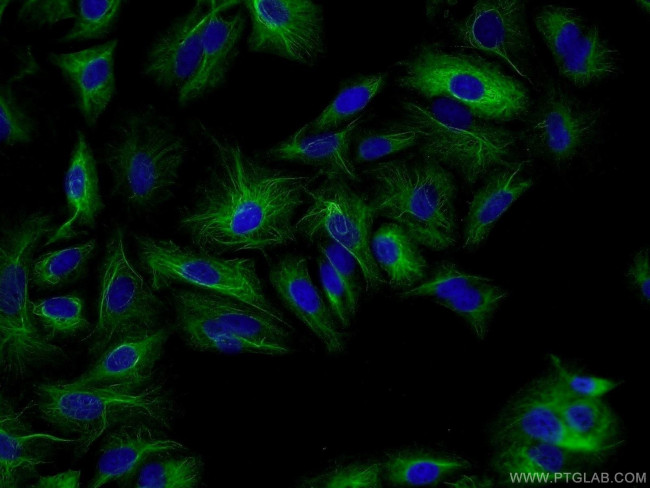 RMND5B Antibody in Immunocytochemistry (ICC/IF)