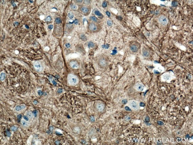 NF-M Antibody in Immunohistochemistry (Paraffin) (IHC (P))