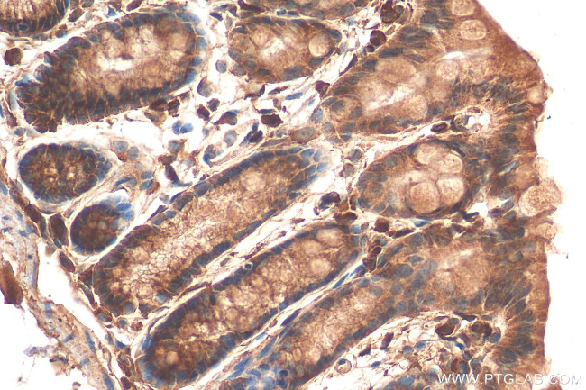 A1CF Antibody in Immunohistochemistry (Paraffin) (IHC (P))