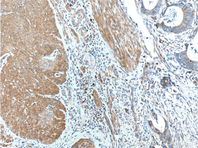 SMCO4 Antibody in Immunohistochemistry (Paraffin) (IHC (P))