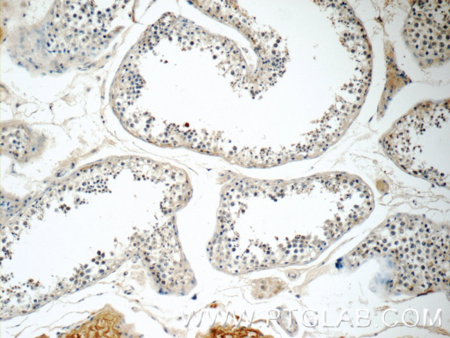 RGSL1 Antibody in Immunohistochemistry (Paraffin) (IHC (P))