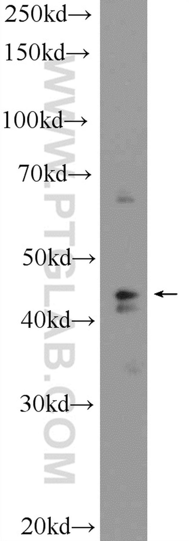 SUDS3 Antibody in Western Blot (WB)