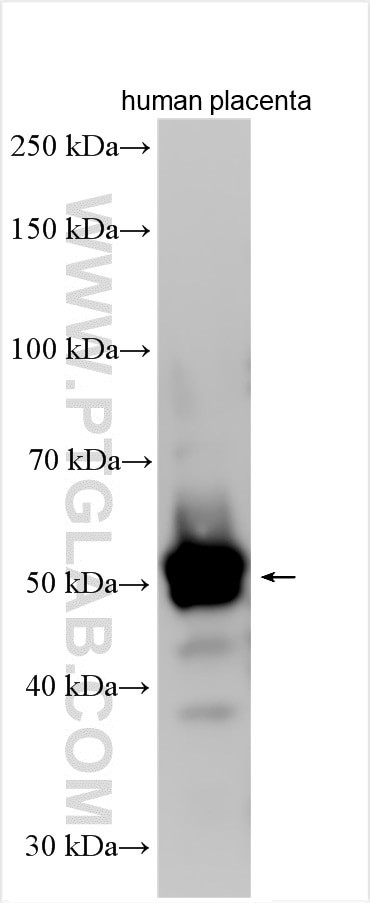 MTFMT Antibody in Western Blot (WB)