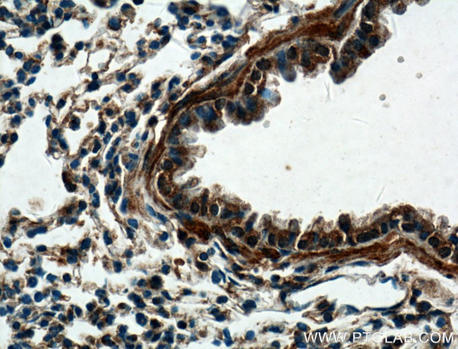 DECR2 Antibody in Immunohistochemistry (Paraffin) (IHC (P))
