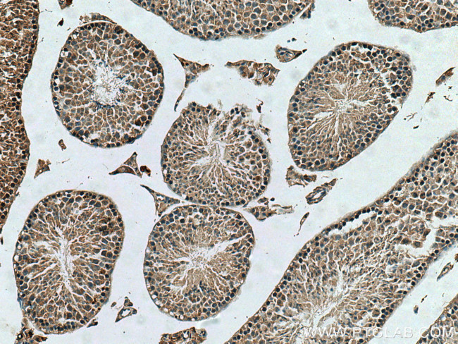 TUBGCP2 Antibody in Immunohistochemistry (Paraffin) (IHC (P))