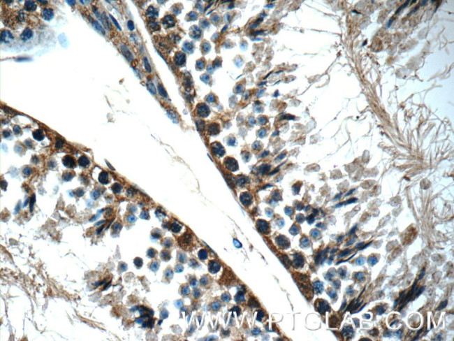 TEX264 Antibody in Immunohistochemistry (Paraffin) (IHC (P))