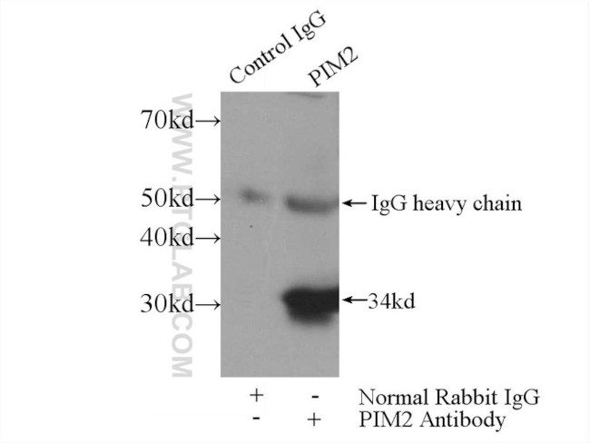 PIM2 Antibody in Immunoprecipitation (IP)