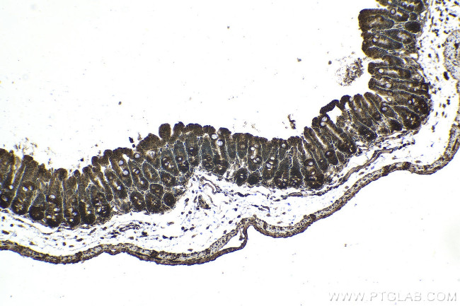 PI3 Kinase p85 Beta Antibody in Immunohistochemistry (Paraffin) (IHC (P))