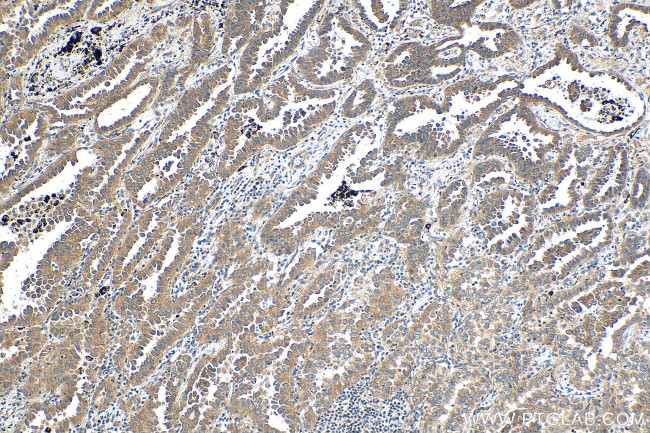 c-Met (Cytoplasmic) Antibody in Immunohistochemistry (Paraffin) (IHC (P))