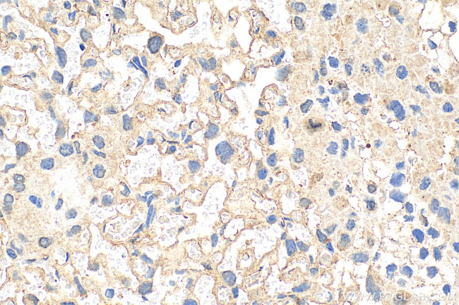Alpha-1-antitrypsin Antibody in Immunohistochemistry (Paraffin) (IHC (P))