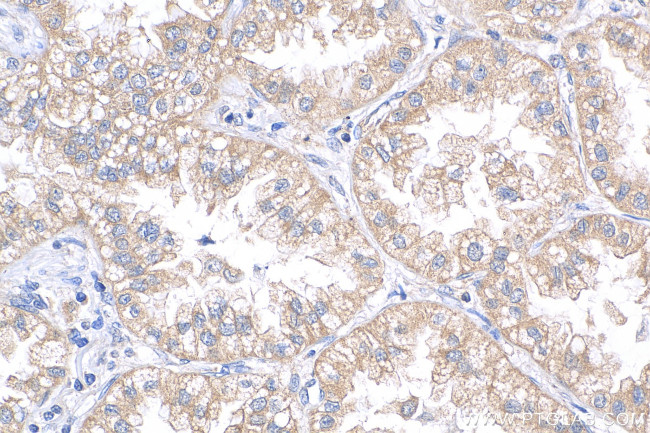 CMPK2 Antibody in Immunohistochemistry (Paraffin) (IHC (P))
