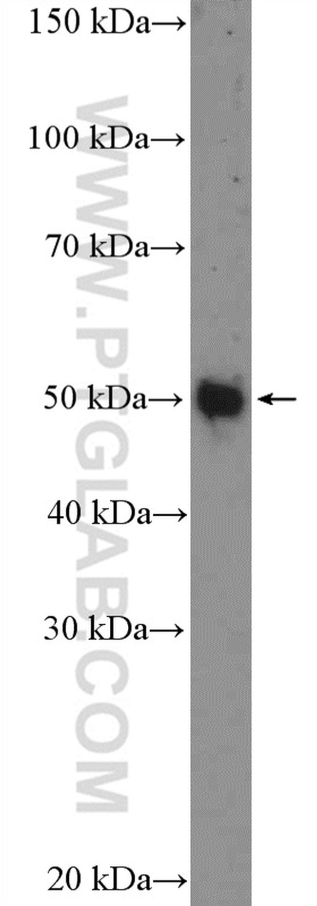 Whirlin Antibody in Western Blot (WB)