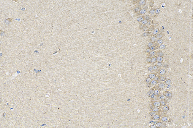 AMHR2 Antibody in Immunohistochemistry (Paraffin) (IHC (P))