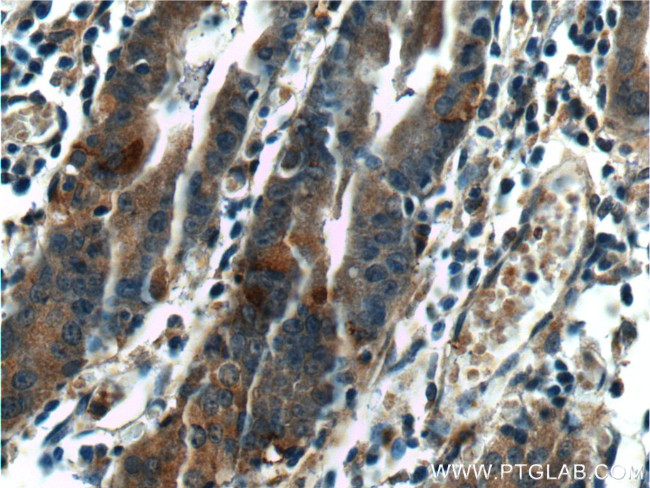 LIPF Antibody in Immunohistochemistry (Paraffin) (IHC (P))