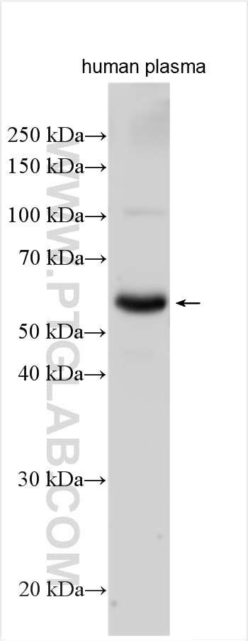 C9 Antibody in Western Blot (WB)