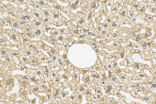 FOXJ1 Antibody in Immunohistochemistry (Paraffin) (IHC (P))