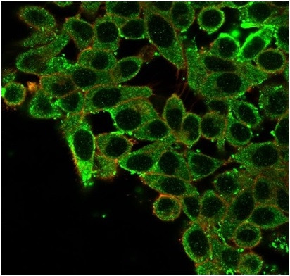 CCR4-NOT transcription complex, subunit 10 (CNOT10) Antibody in Immunocytochemistry (ICC/IF)