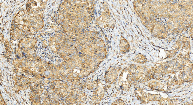 CBARA1 Antibody in Immunohistochemistry (Paraffin) (IHC (P))