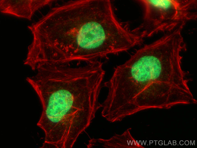 ZNF592 Antibody in Immunocytochemistry (ICC/IF)