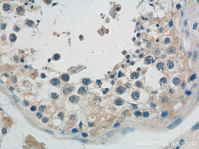 PEMT Antibody in Immunohistochemistry (Paraffin) (IHC (P))