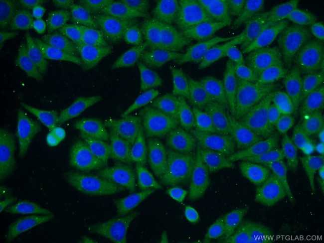 GMIP Antibody in Immunocytochemistry (ICC/IF)
