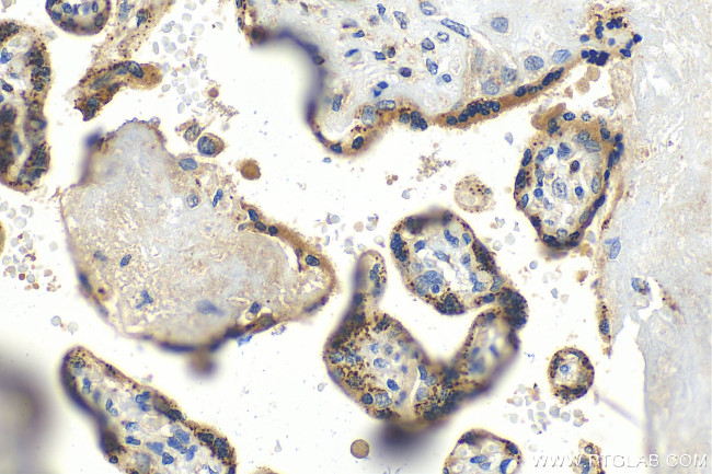 MAN1C1 Antibody in Immunohistochemistry (Paraffin) (IHC (P))
