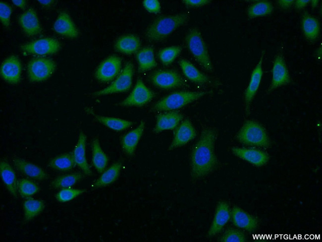 APOL2 Antibody in Immunocytochemistry (ICC/IF)
